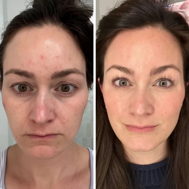 GoldenTallow™ Repair Balm