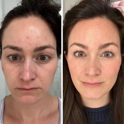 GoldenTallow™ Repair Balm