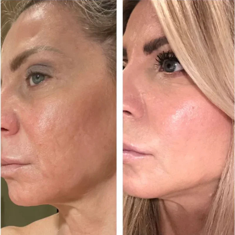 GoldenTallow™ Repair Balm